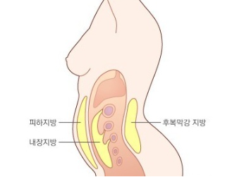 내장 지방