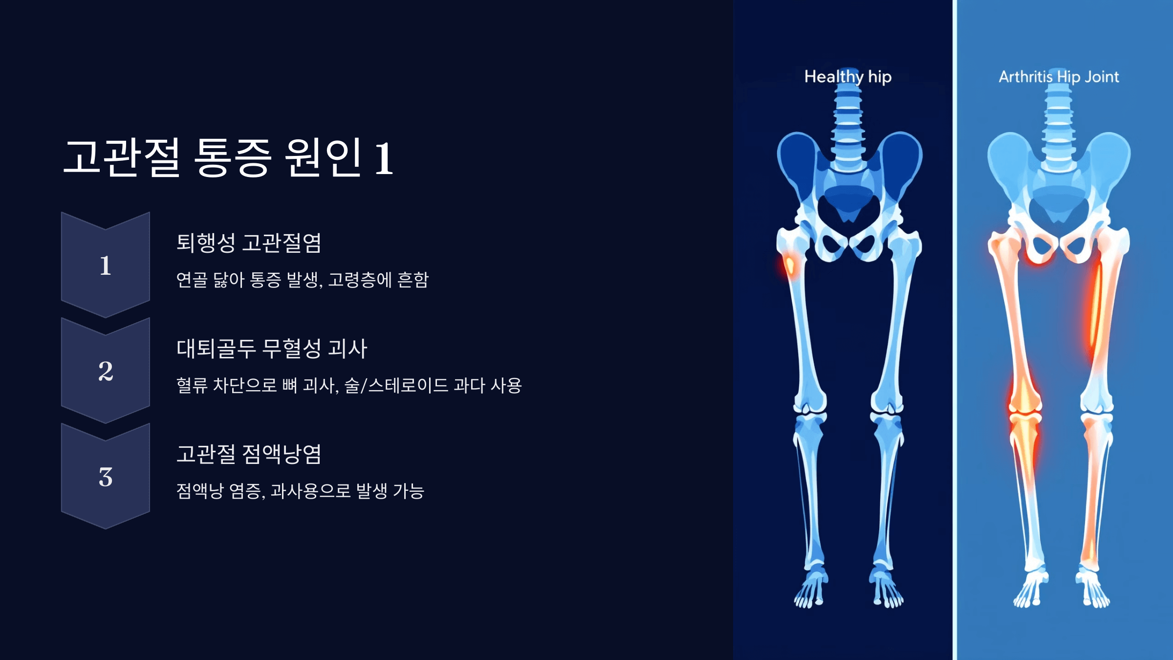 고관절 통증과 관련된 사진입니다.