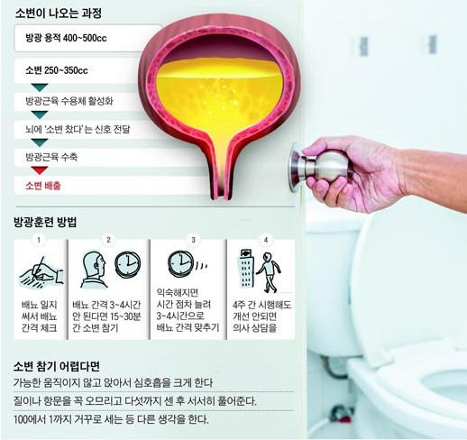 방광암 초기진단