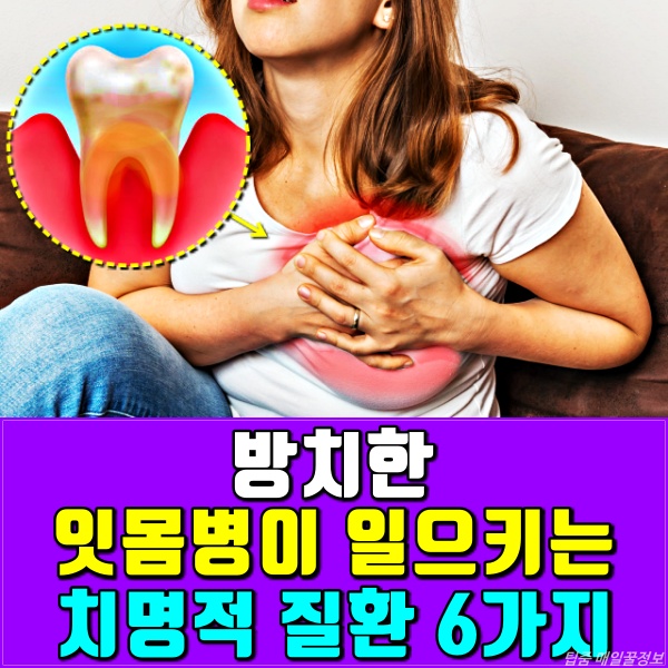 이가 시릴때,잇몸이 붓고 아플때,치주염,풍치,팁줌