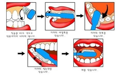 아침 양치 언제, 어떻게 하는 것이 가장 효과적일까?