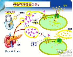식사 시간과 RUNX3