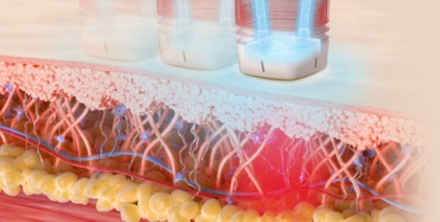 체형관리 장비 부문