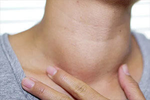 갑상선에 좋은 음식02