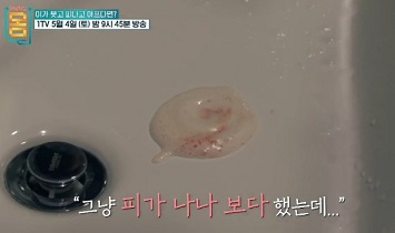 양치할때피가남