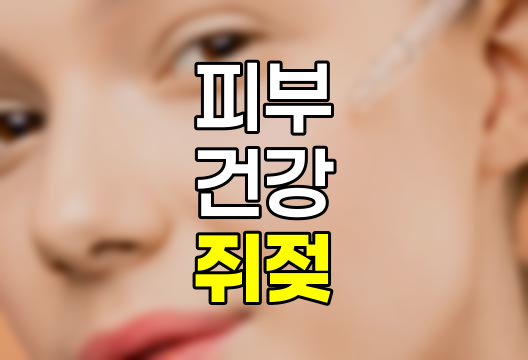쥐젖 발생 원인, 제거 방법, 실비보험 적용 및 연고 사용 정보