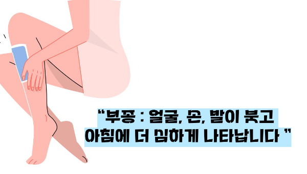 사구체신염 증상 원인