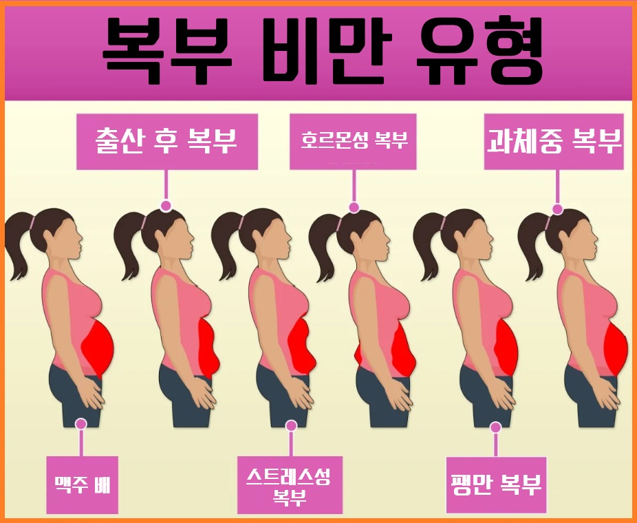 복부비만 유형