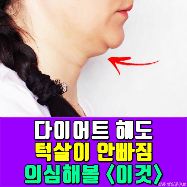 다이어트,턱살,턱밑살,이중턱,사각턱,턱선,턱밑이 붓는 이유,침샘 비대증,건강 팁줌 매일꿀정보