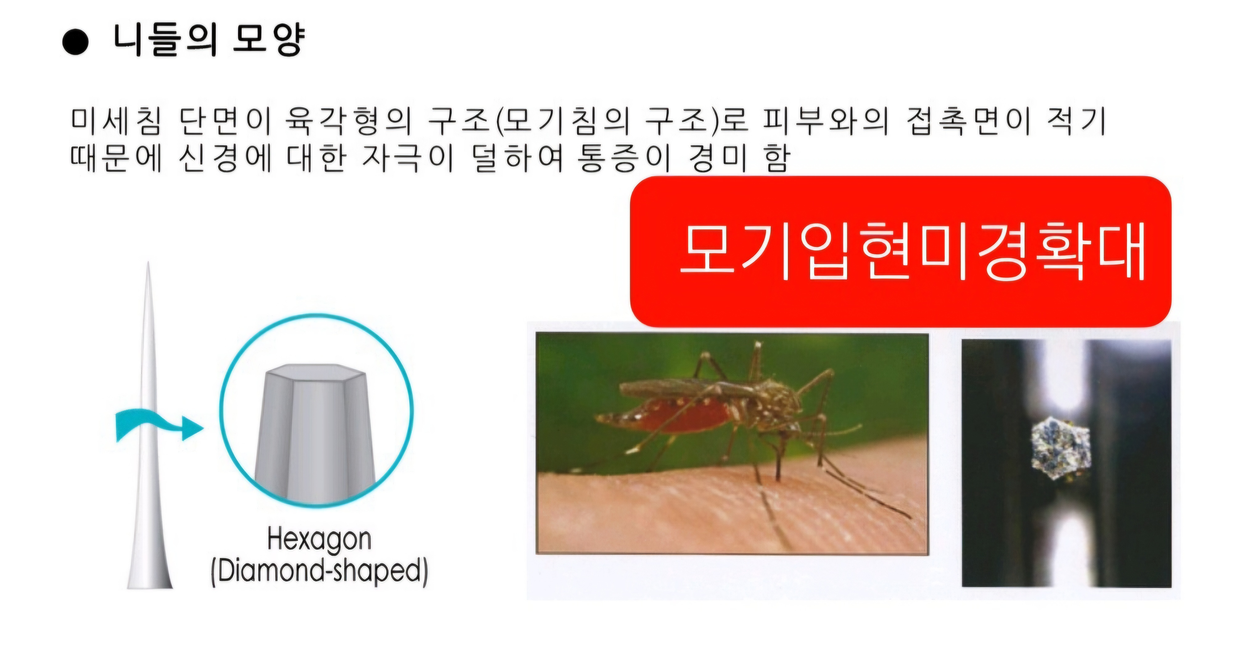 제노시스에서는 모기입의 모양을 활용 해 MTS 바늘을 창안하게 된 이유, MTS 시술시 통감이 덜 해서 시술 받는자가 편안하게 받을 수 있어 정말 획기적이다