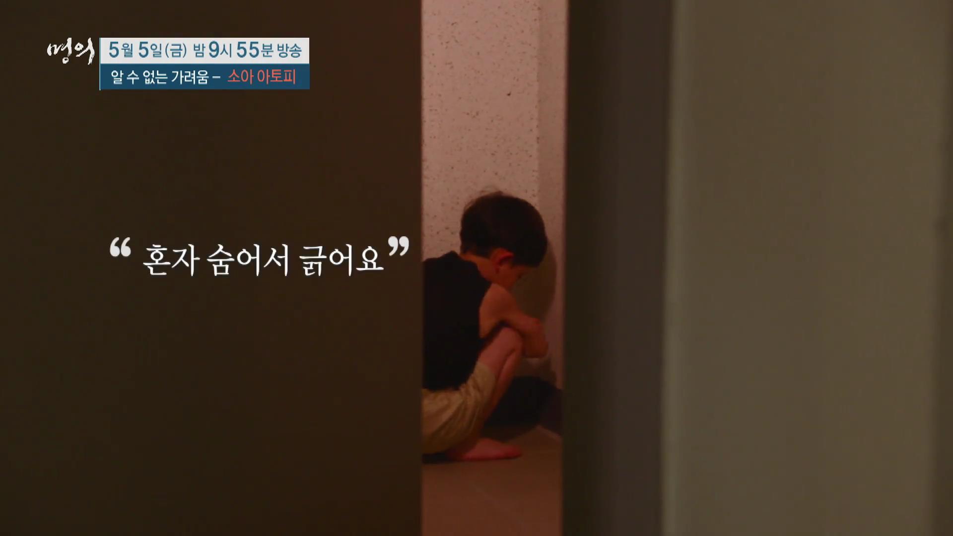 명의 어린이 소아 아토피 피부염 스테로이드 효과 및 부작용 완치 치료제 신약 비용 방법