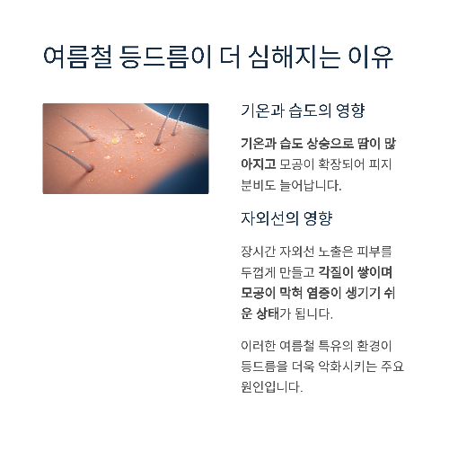 등드름 원인부터 치료까지, 깨끗한 등 피부를 위한 완벽 가이드