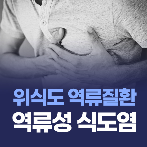위식도 역류질환