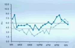 위산이 적은 오전에 프로바이오틱스를 먹어라.