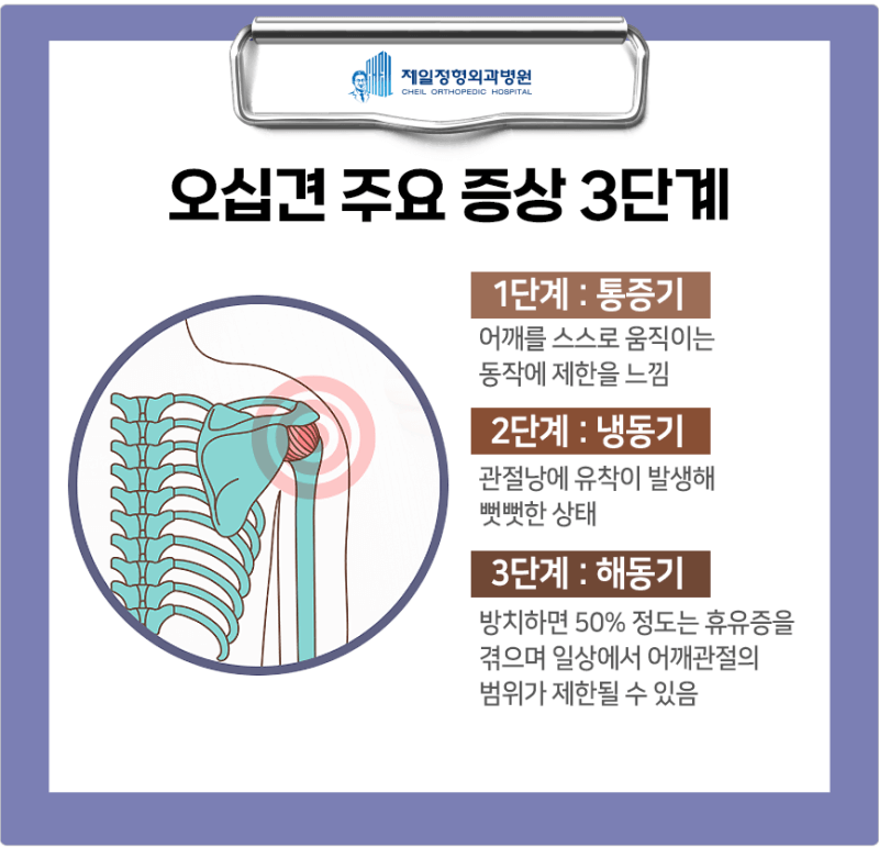 오십견
