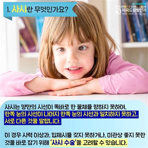 성인 사시 수술