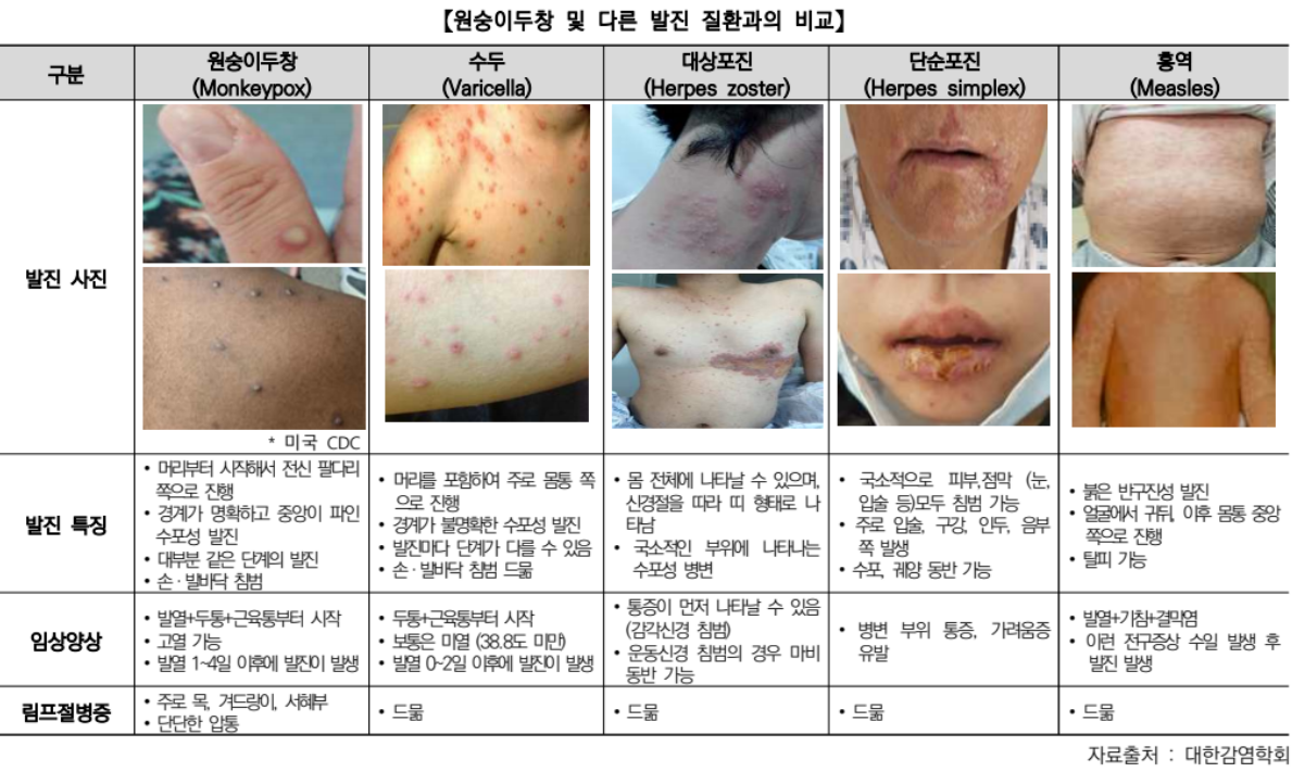 원숭이두창(Monkeypox) 질병