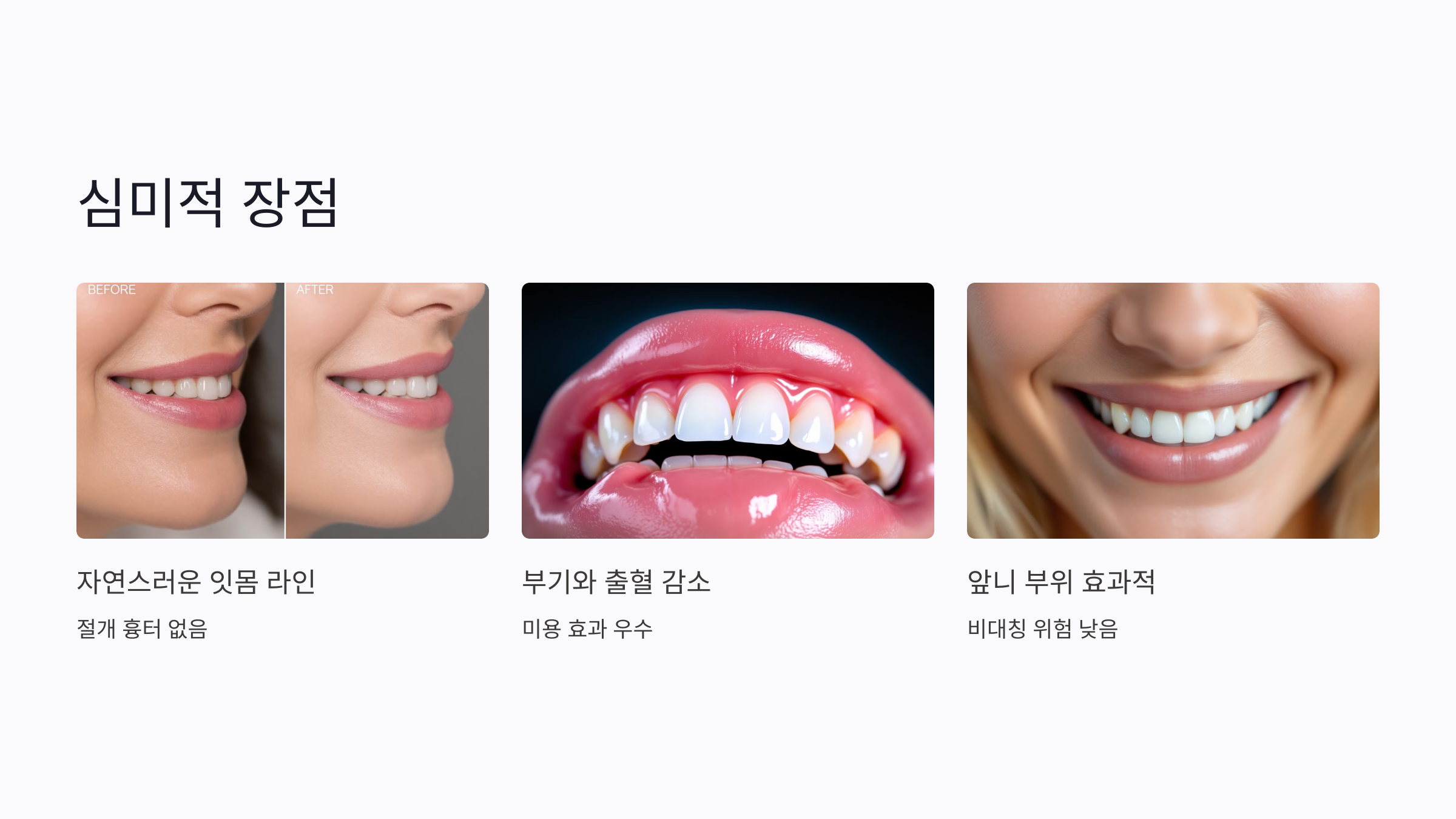 심미적인 결과도 중요한가요?