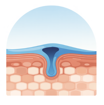 쯔쯔가무시 증상