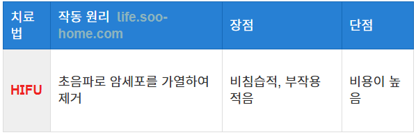 초음파 치료의 최신 기술