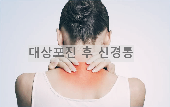 대상포진 후 신경통