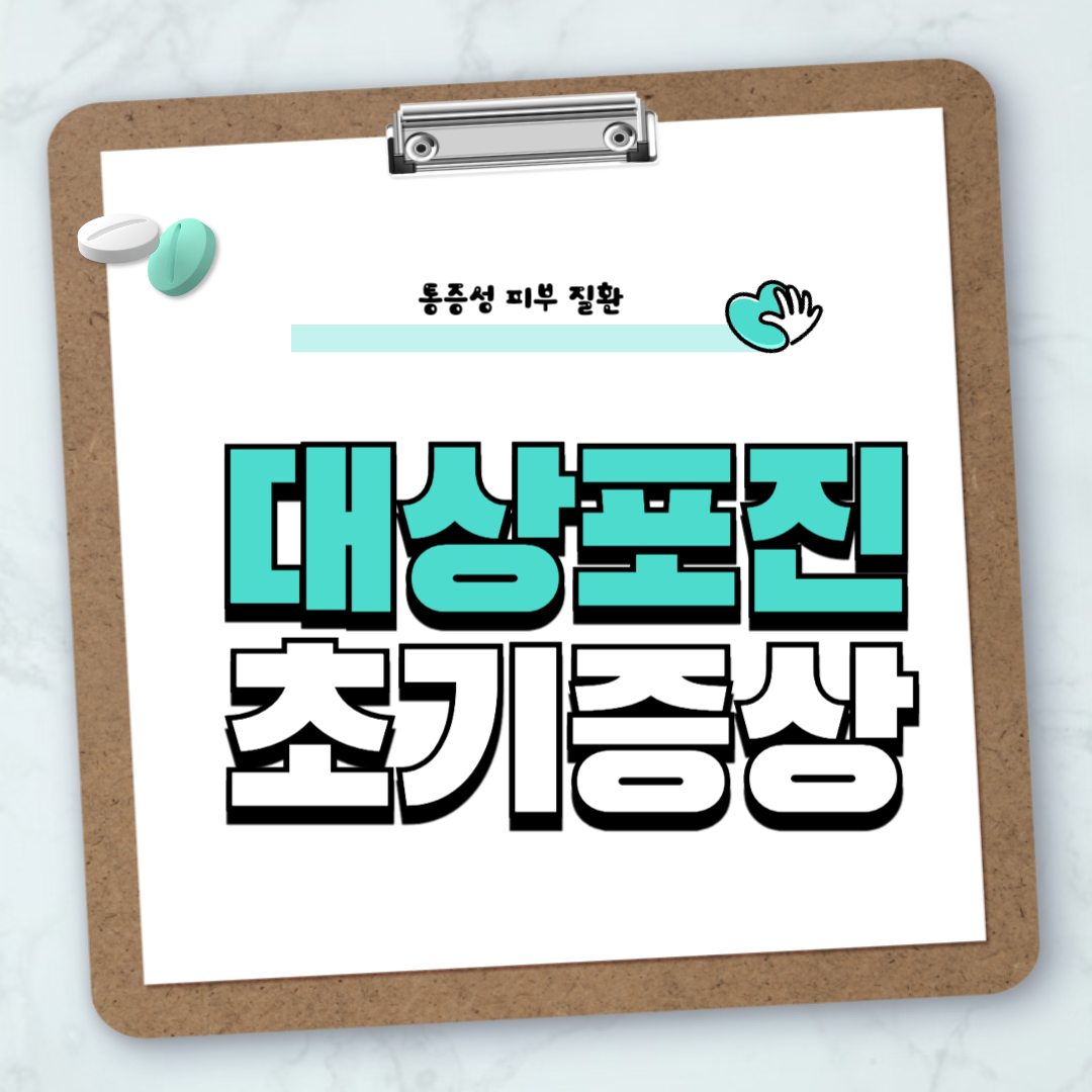 대상포진초기증상