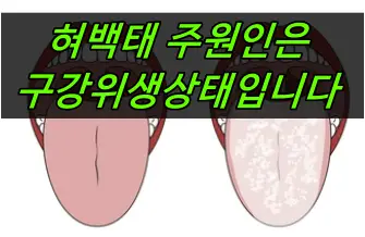 혀백태 원인