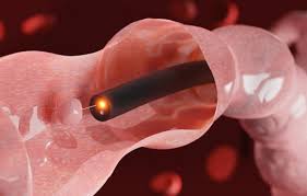 대장내시경 비용 총정리