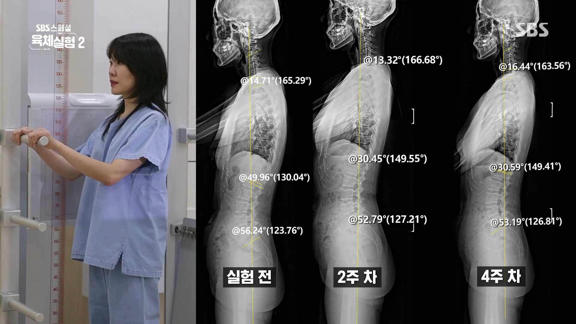 거북목 알림 진동 기계 힐디넥 에그 SBS 스페셜 육체실험 바른 자세