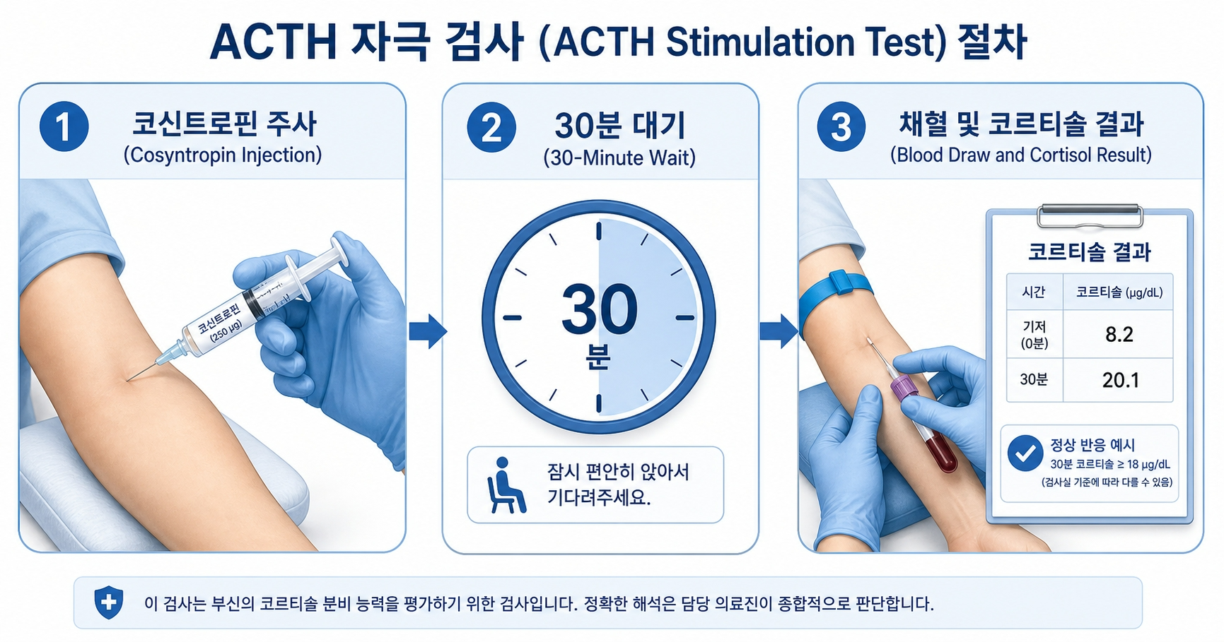 ACTH 자극 검사 부신저하증 확진 방법