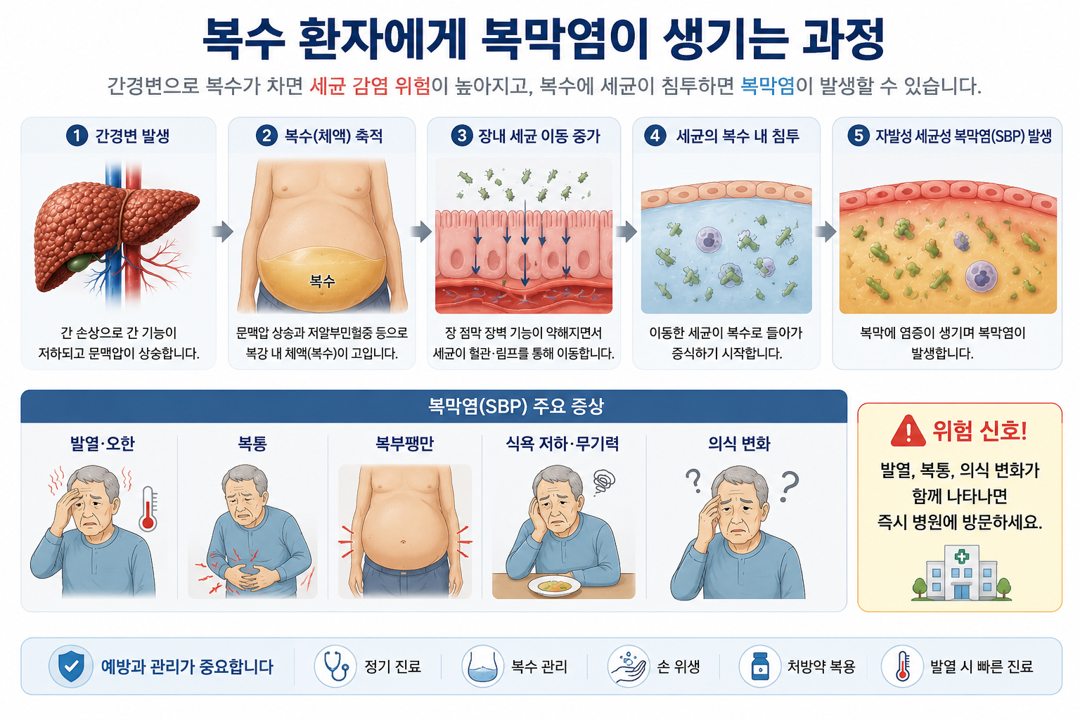 복수가 있는 간경변 환자에서 세균 감염으로 자발성 세균성 복막염이 발생하는 과정을 설명하는 의료 인포그래픽 이미지