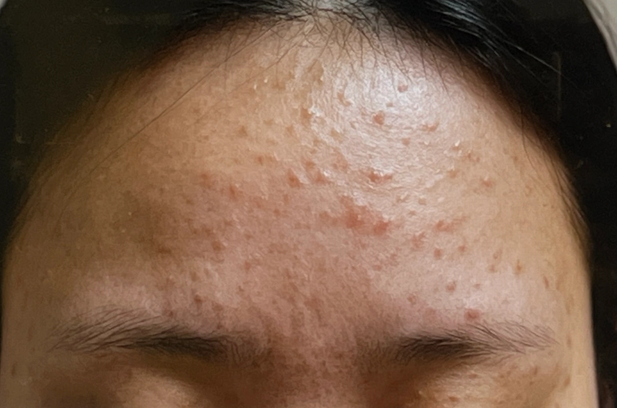 이소켈리-내돈내산-후기-작성-위해-찍은-딸아이-사진