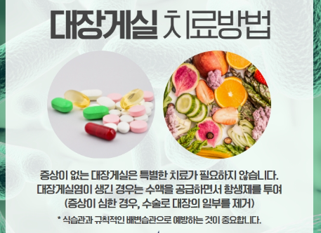 게실염 예방 치료