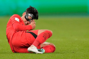 손흥민 안와골절 마스크