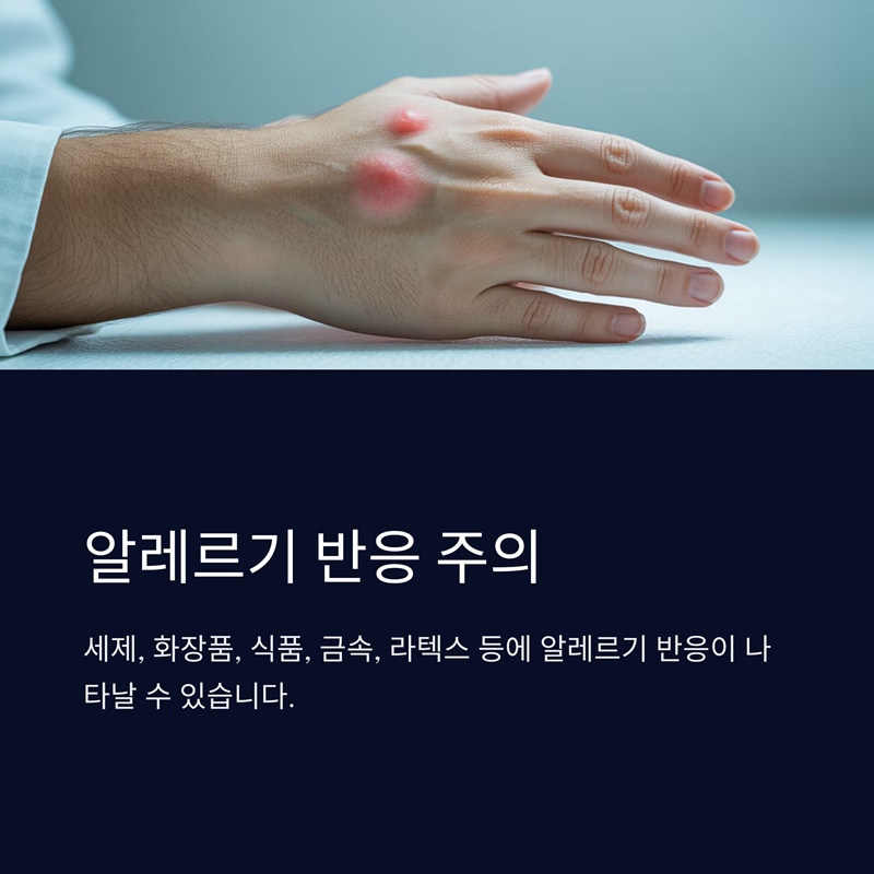 알레르기 반응