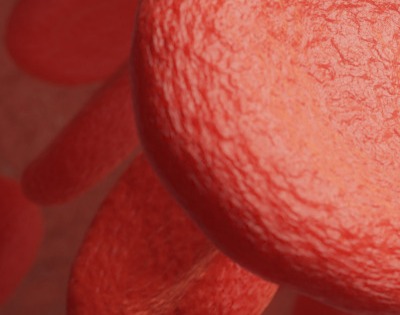 관상동맥 석회화 증상