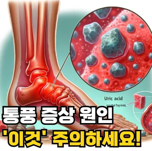 통풍 증상 원인