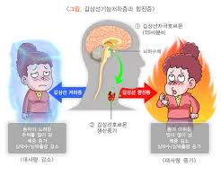 갑상선기능 저하증이란 무엇인가.