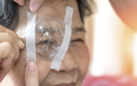 백내장 수술비용 초기증상 최저가 확인방법