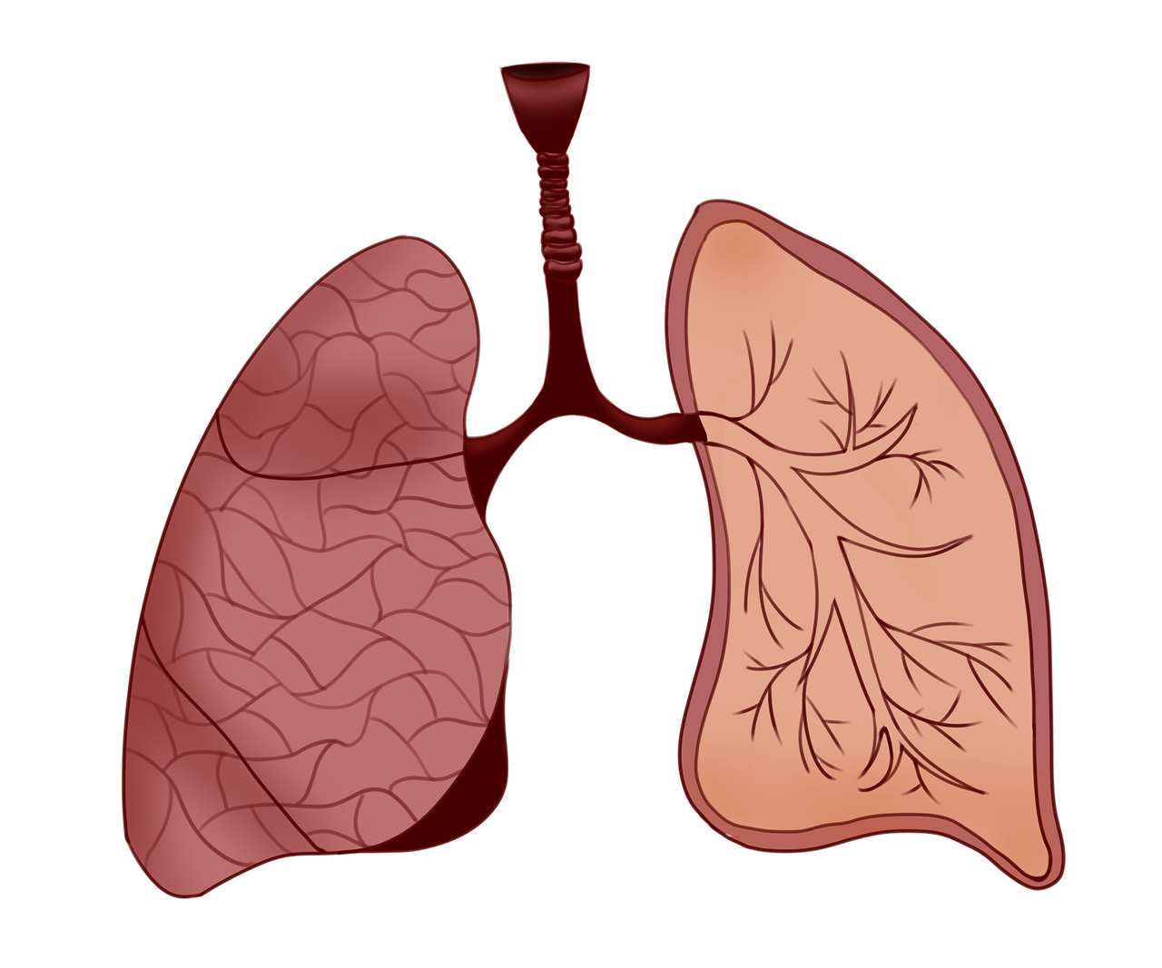 진폐증(Pneumoconiosis)이란? : 광부·건설노동자의 침묵의 적, 폐 속에 쌓인 먼지의 경고