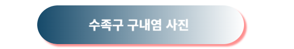 수족구, 수족구 증상, 수족구 초기 증상, 수족구 예방, 수족구 대처방법, 수족구 열, 수족구 수포