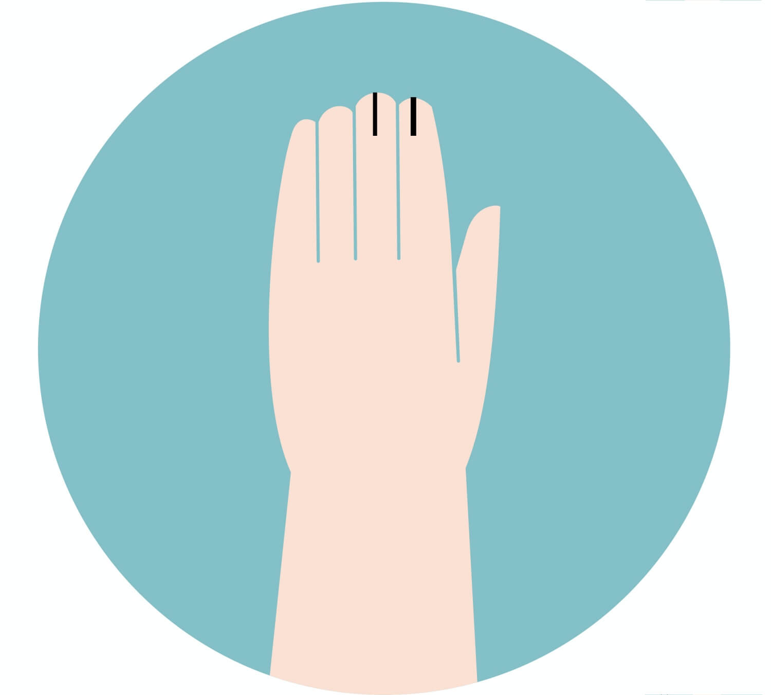 검은세로줄이-생긴-손톱