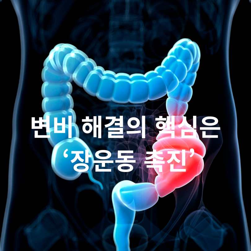 변비 해결 운동 BEST 7