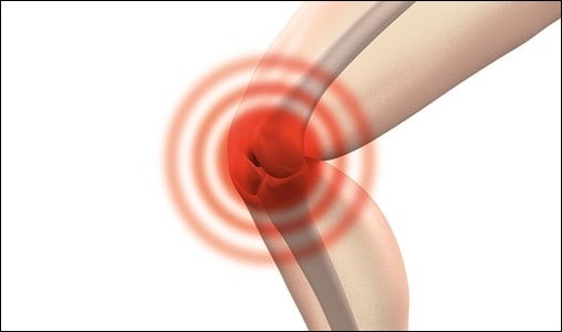 관절염증,통증 영양제 궁합(보스웰리아,콘드로이친)