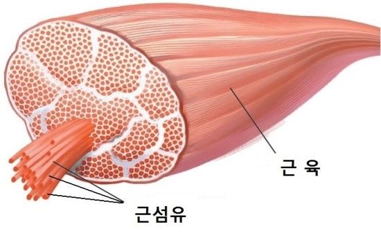 섬유근육통 증상