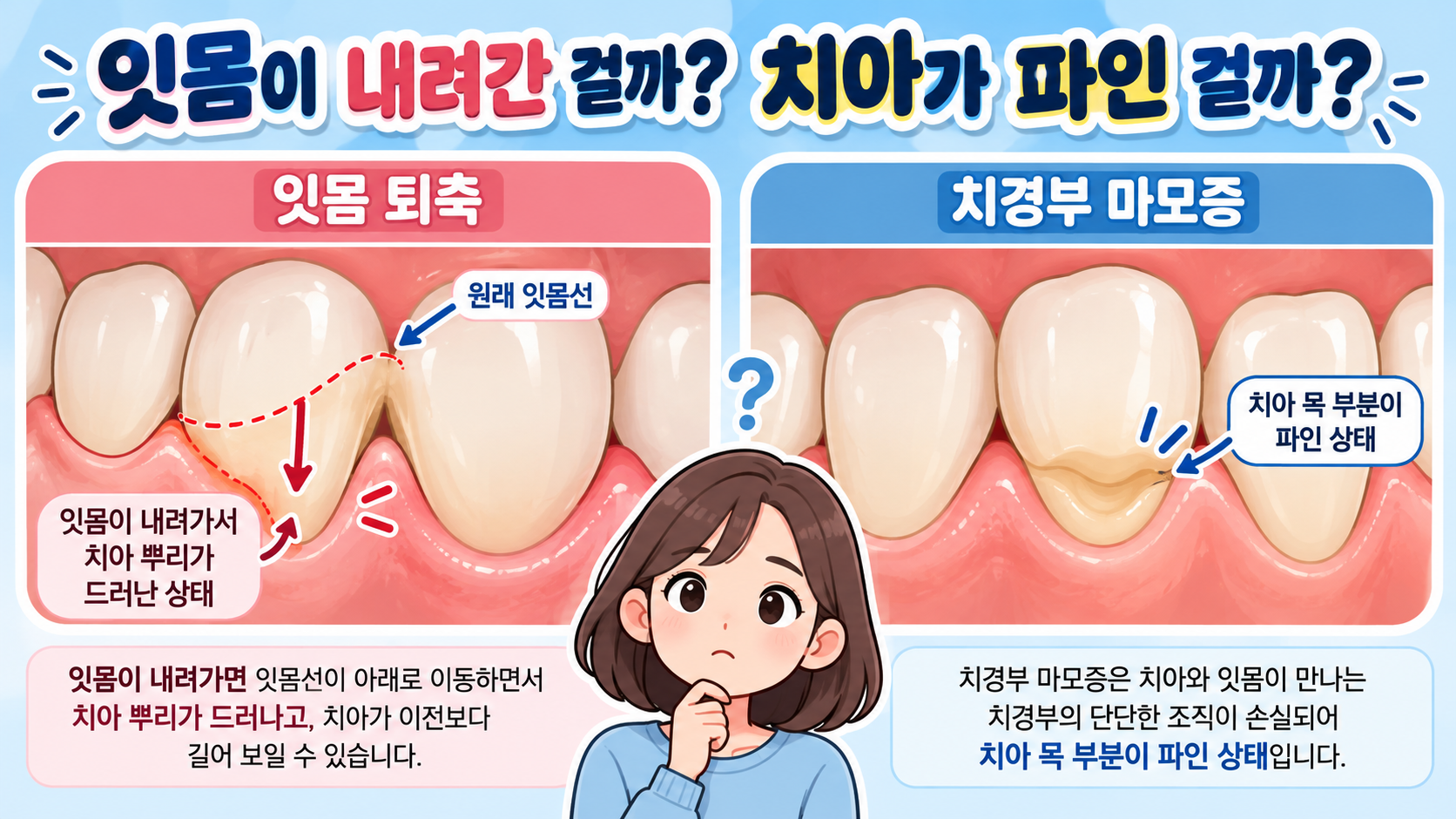 잇몸이 내려간 걸까? 치아가 파인 걸까?