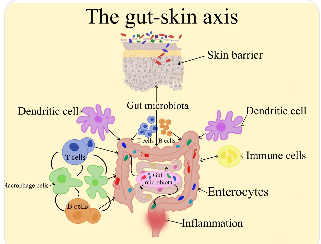 장 건강과 피부 상태가 연결되어 있다는 장-피부 축 설명 삽화