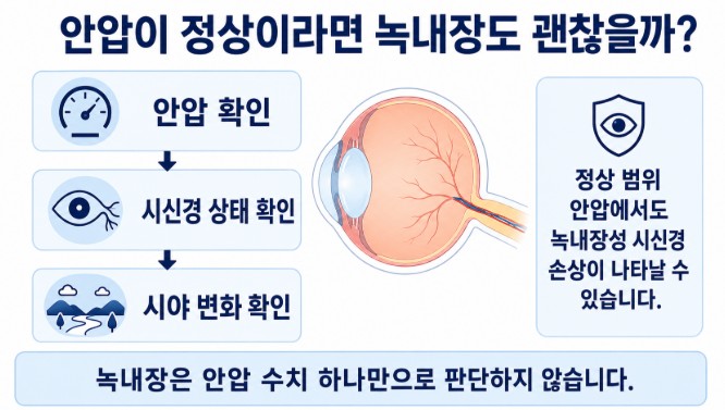 정상 범위 안압에서도 녹내장성 시신경 손상이 나타날 수 있어 안압과 시신경 상태를 함께 살펴보는 이유