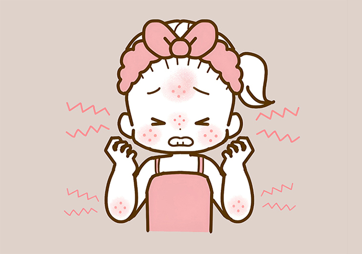 녹용-알레르기가-있는-여성