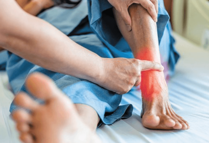 통풍의 초기증상은 어떤 것들이?